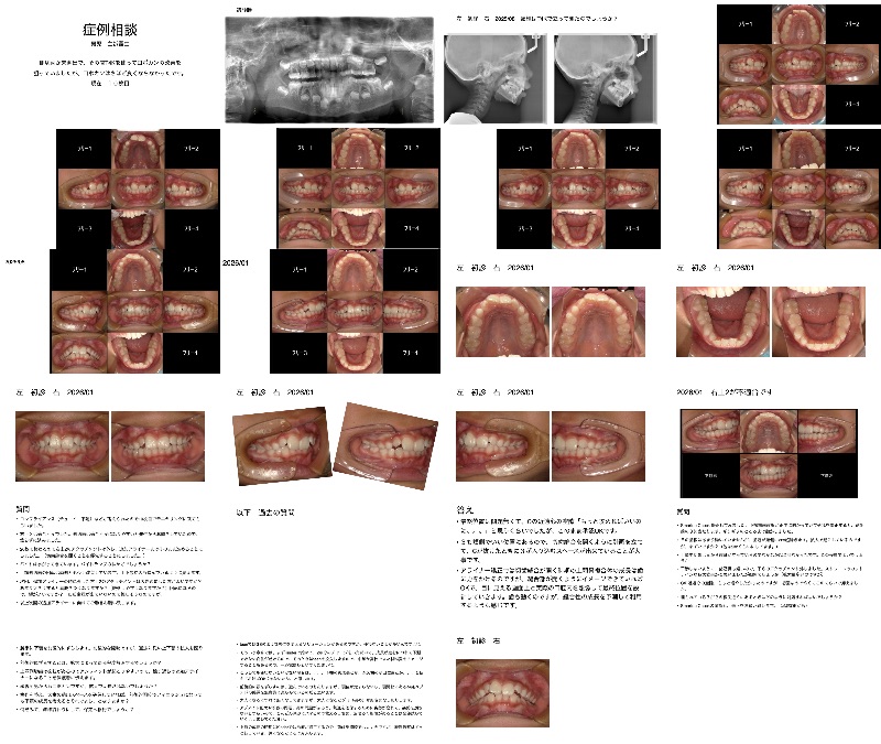 10/20枚Kinderの経過観察