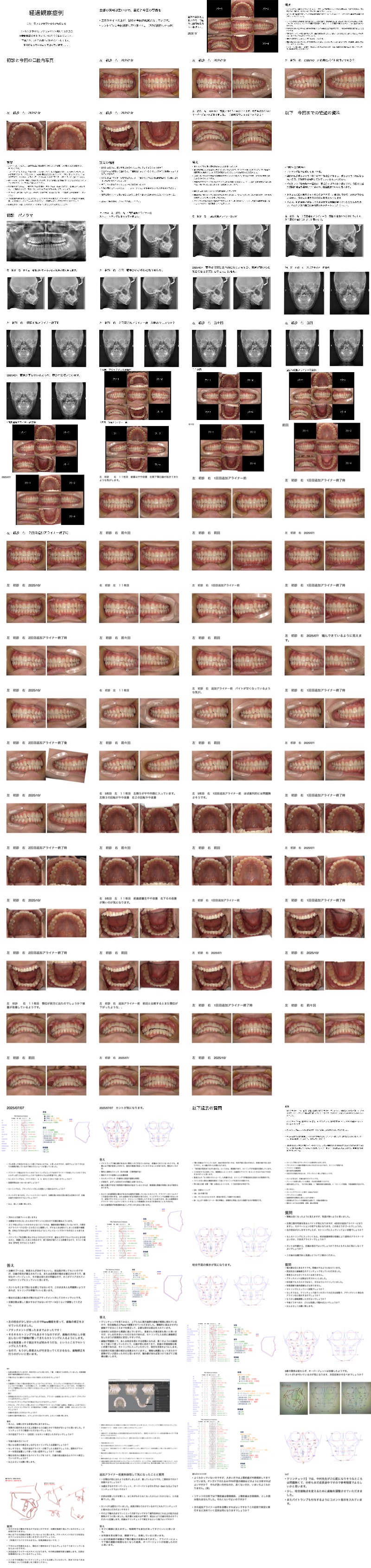 クリンチェック