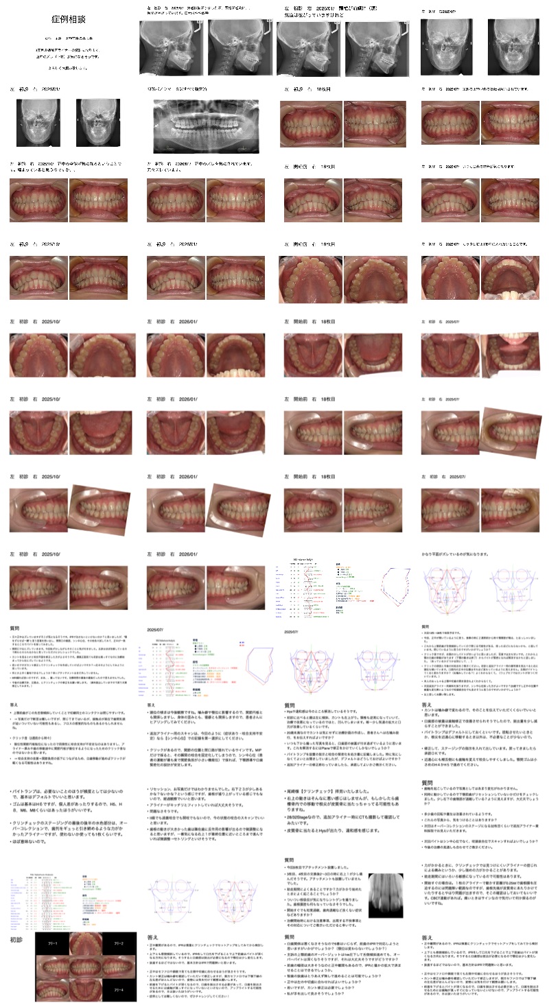 クリンチェック