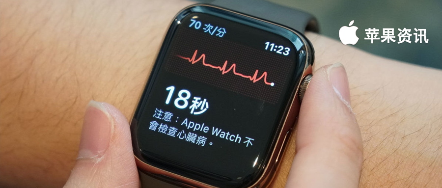 終於來了！中國大陸地區 Apple Watch 將支援心電圖功能