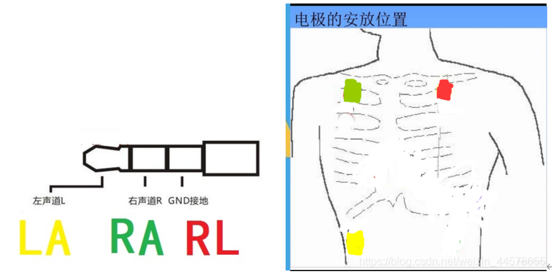 在這裡插入圖片描述