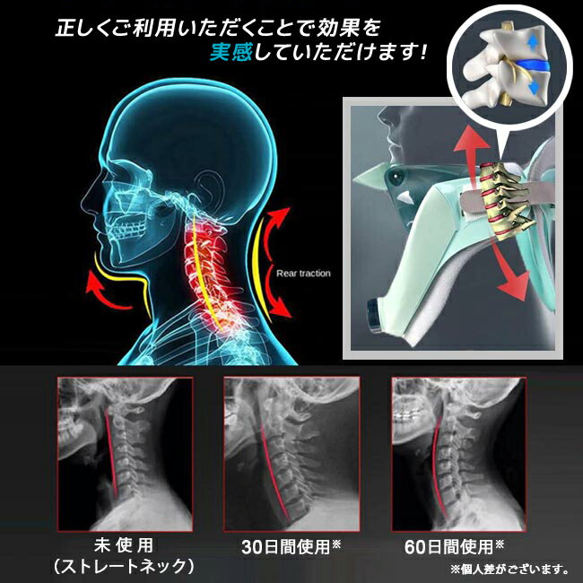 ネックストレッチャー 首ストレッチ 首ストレッチャー 首ほぐし 首筋ストレッチ 肩こり 首 コリ 疲れ 矯正 首矯正 健康グッズ 前かがみ 誕生日  プレゼント 肩 頸部サポーター 頚椎 | シェア買いならシェアモル（旧ショッピン）