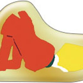 ゴースト トリック ピンズ シセル